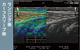 カーフスリーブ無 ランニング後
