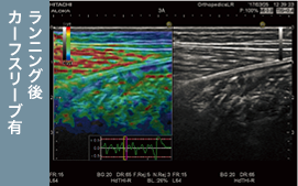 カーフスリーブ有 ランニング後