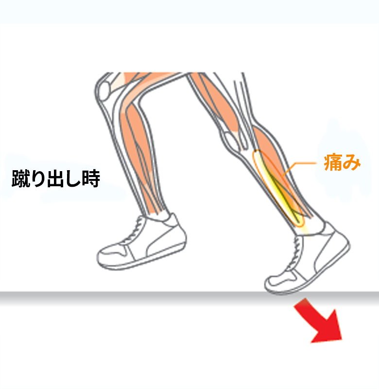 図2:蹴り出し時の痛み