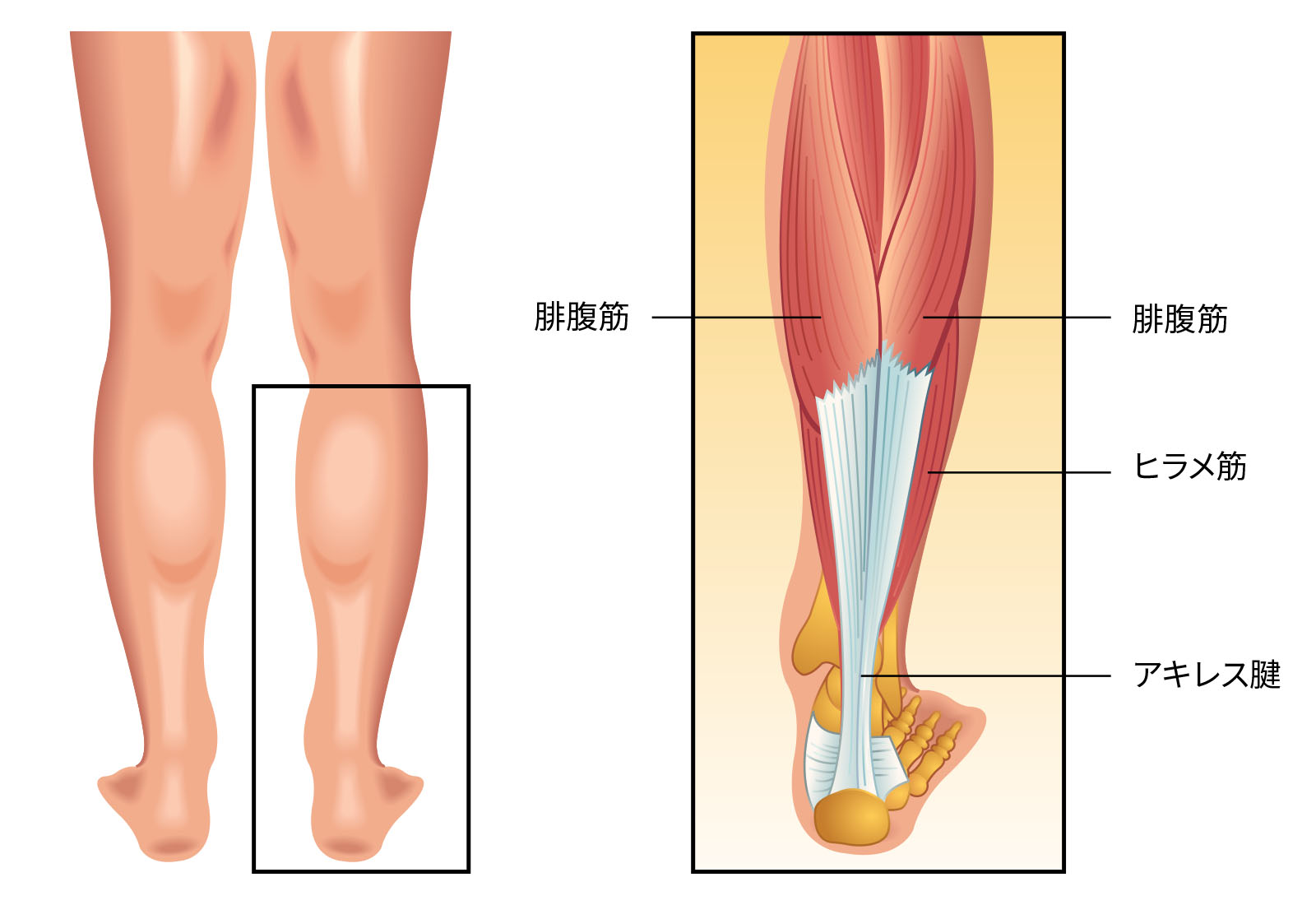 アキレス腱炎・アキレス腱周囲炎