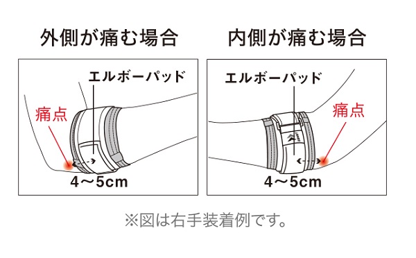 エルボーバンド装着のポイント