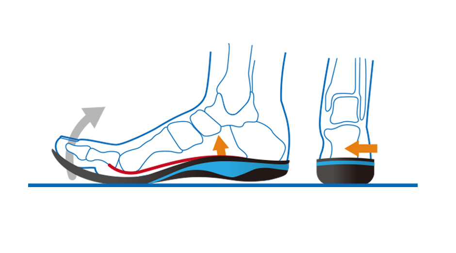 ウィンドラスメカニズム