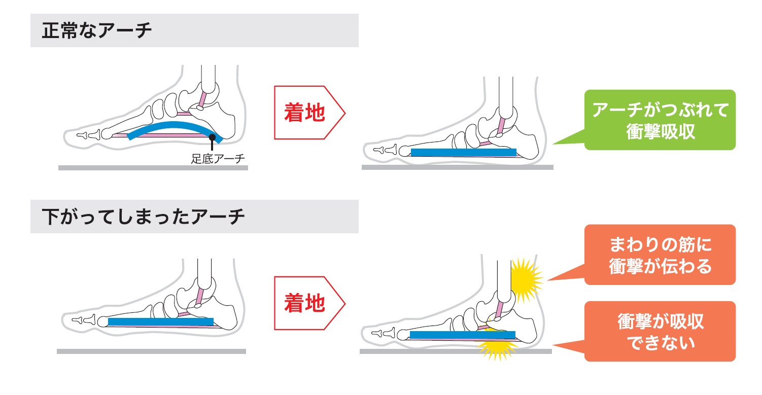 アーチについて