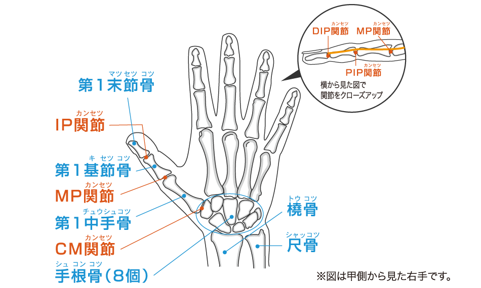 突き指